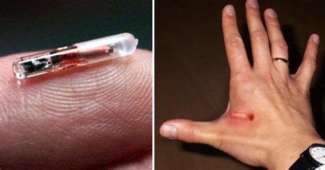 sore from rfid chip|rfid microchip uses.